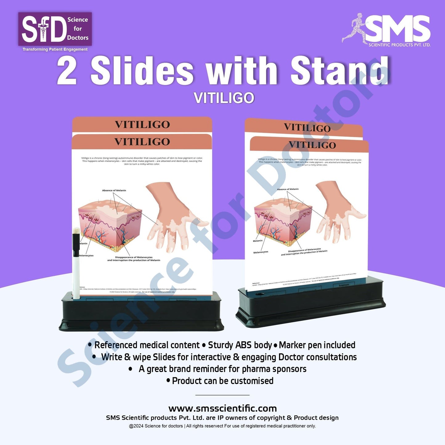 Vitiligo: 2 Slides on stand