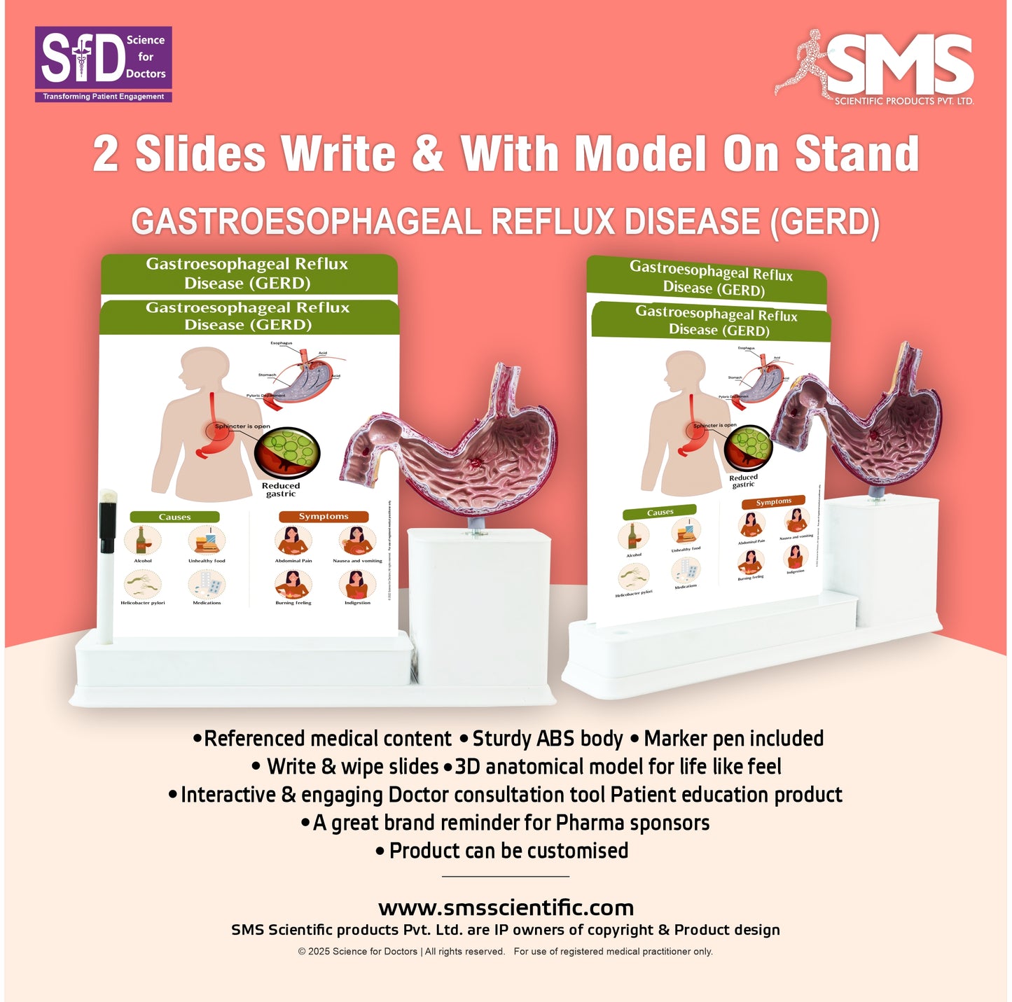 Gastroesophageal Reflux Disease: 2 Slides Write and Wipe with Model On Stand