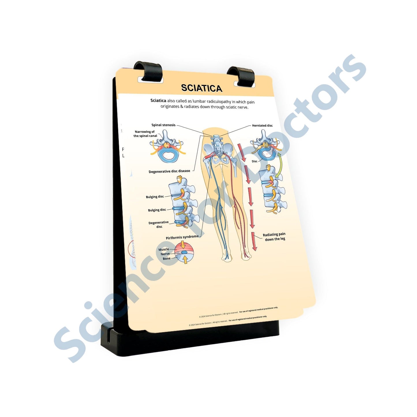 Sciatica: A4 Flip Wipe