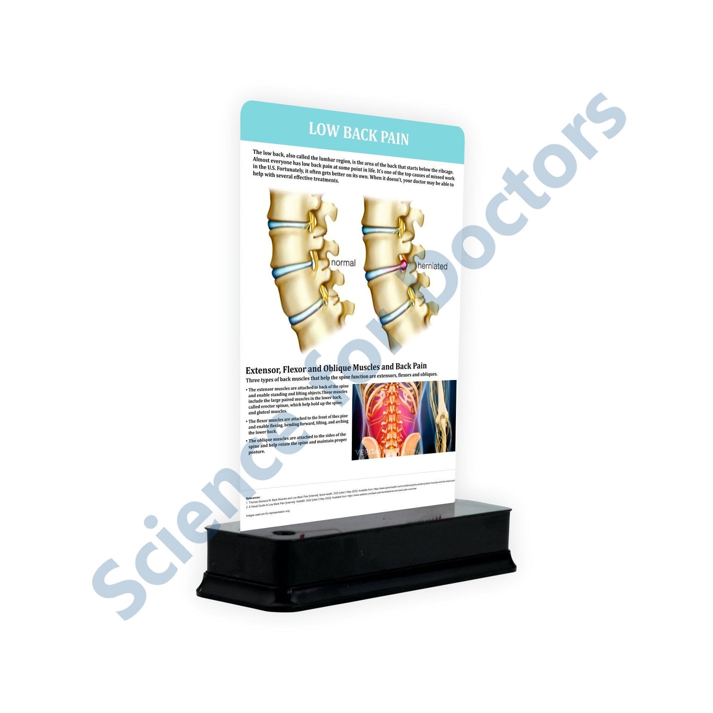 Low Back Pain: 1 Slide on stand