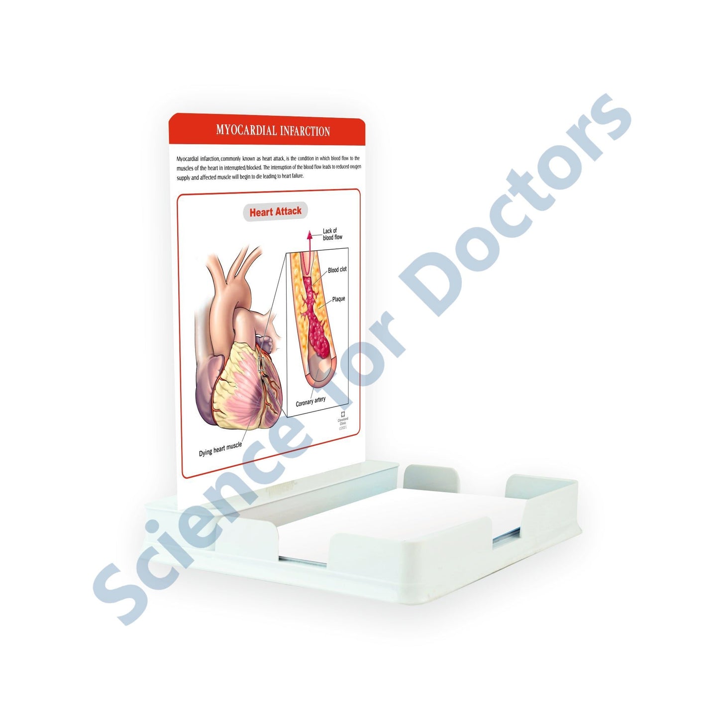 Myocardial Infarction_2: One slide with Tray