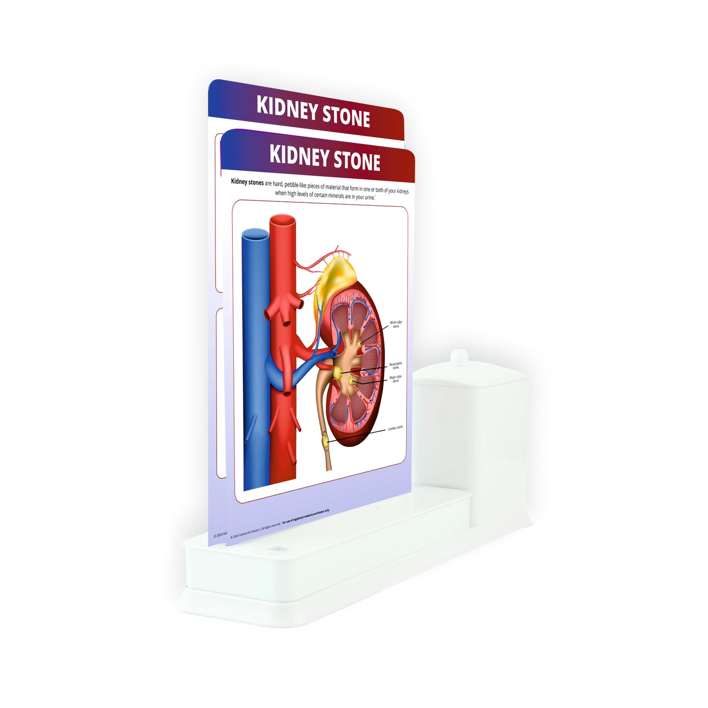 Kidney Stone: 2 Slide Write Wipe With Utility Container