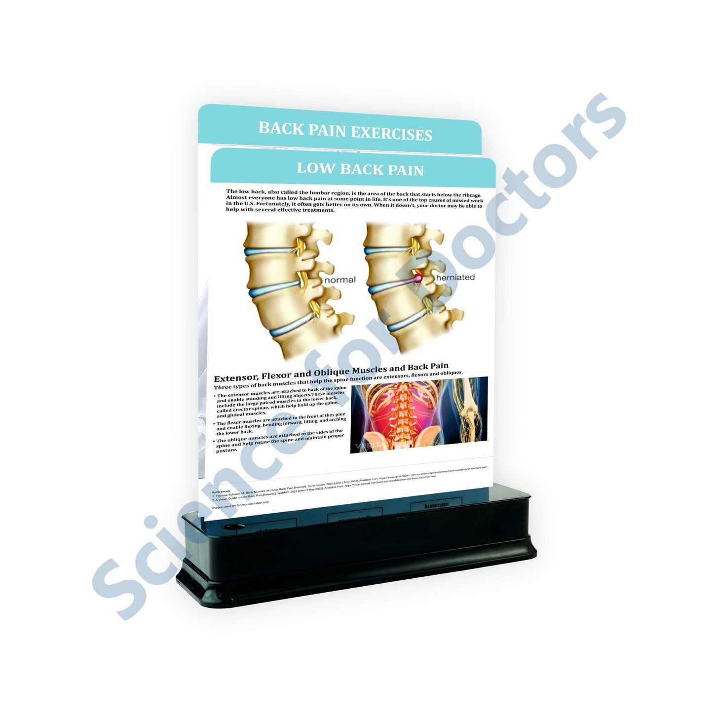 Low Back Pain: 2 Slides on stand