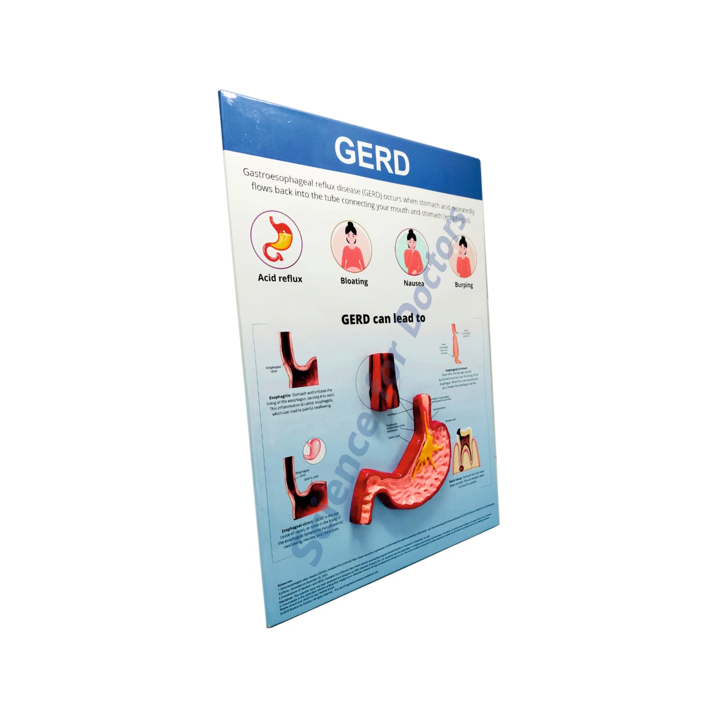 GERD: 3D Therapy Board