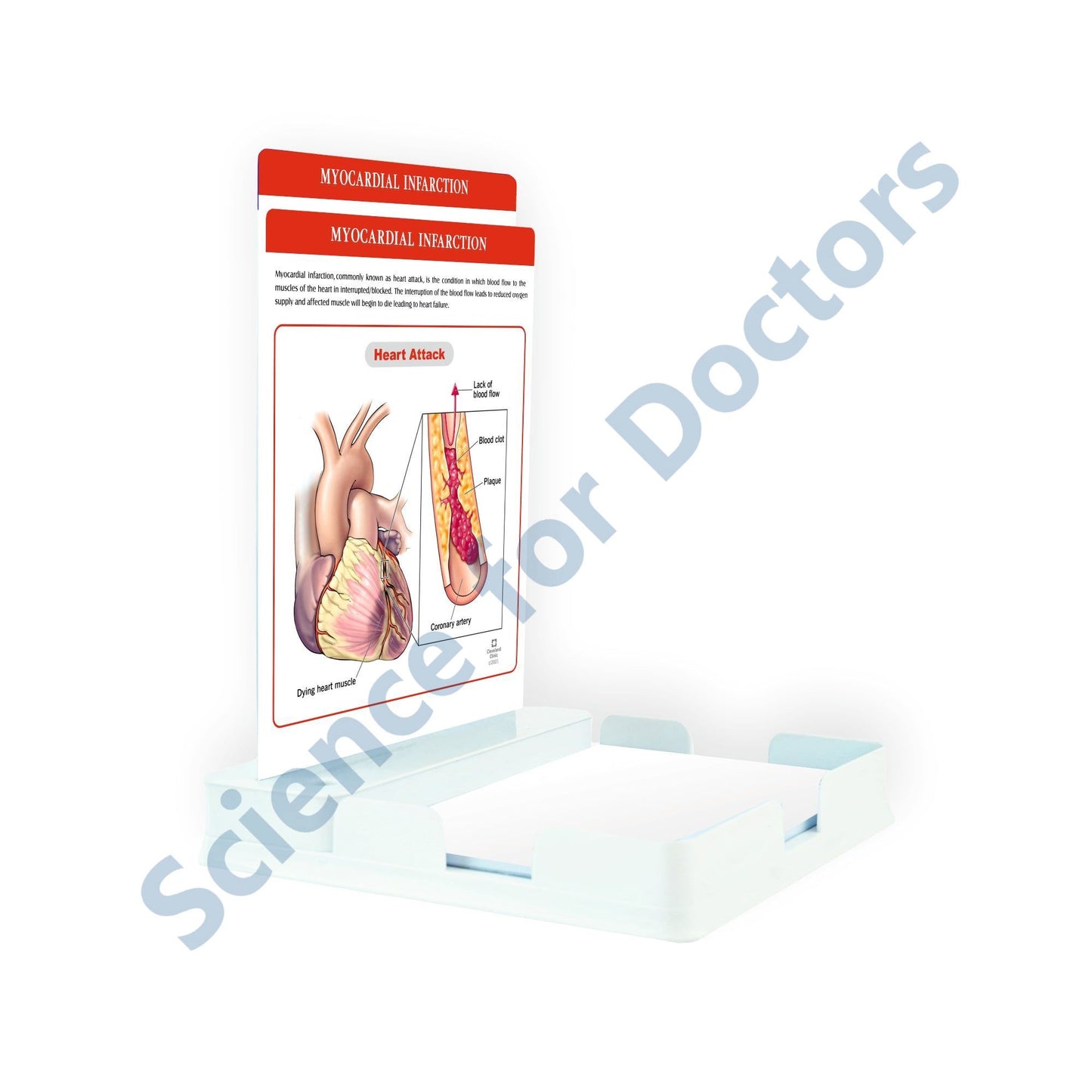 Myocardial Infarction_1: 2 Slides Patient Leaflet Tray