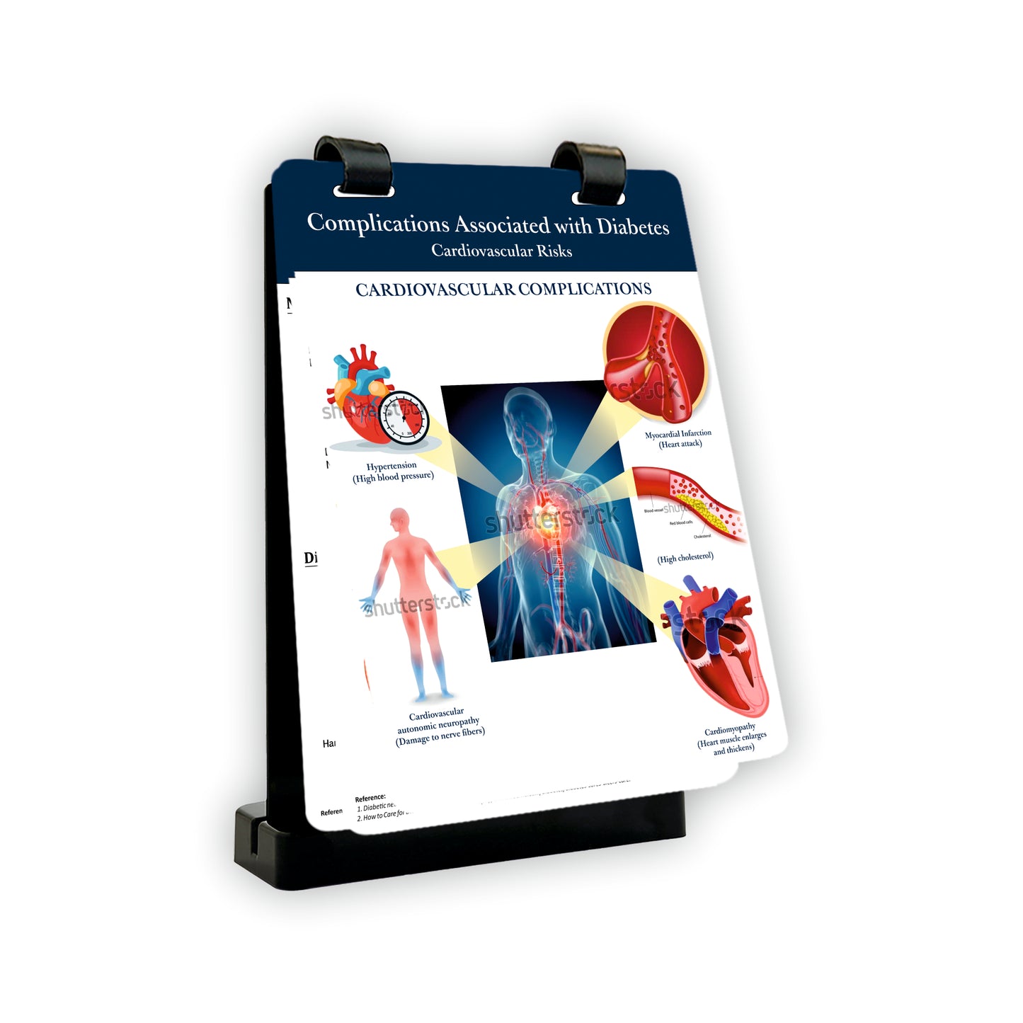 Complications With Diabetes: A4 Flip Wipe