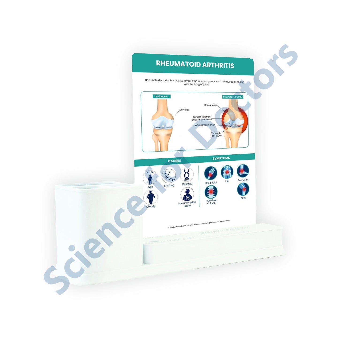 Rheumatoid Arthritis: 1 Slides Write & Wipe with Stationary Stand
