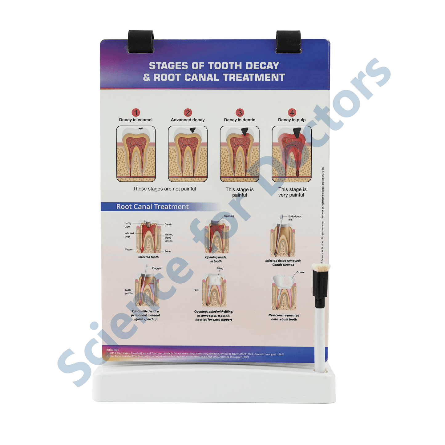Stages of tooth decay & root canal treatment: A4 Flip Wipe
