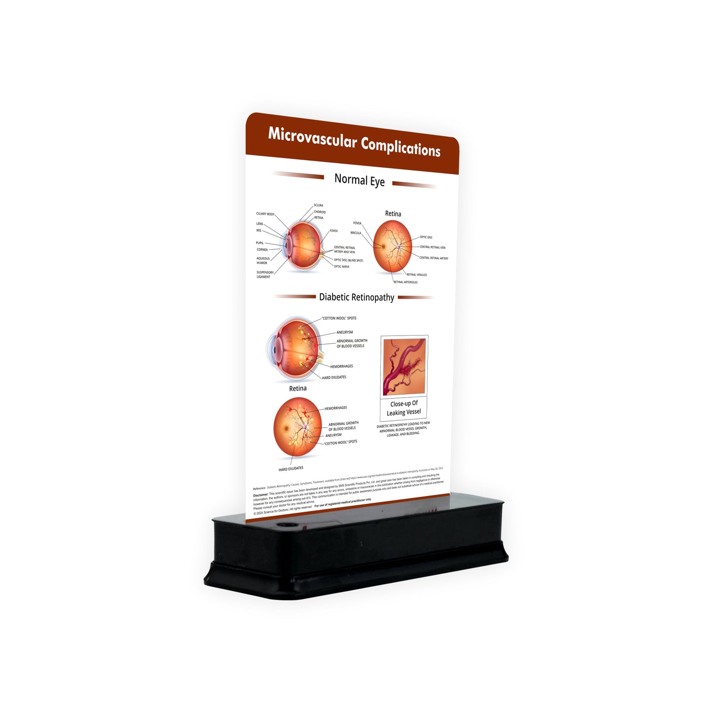 Microvascular Complications_1: 1 Slide on stand