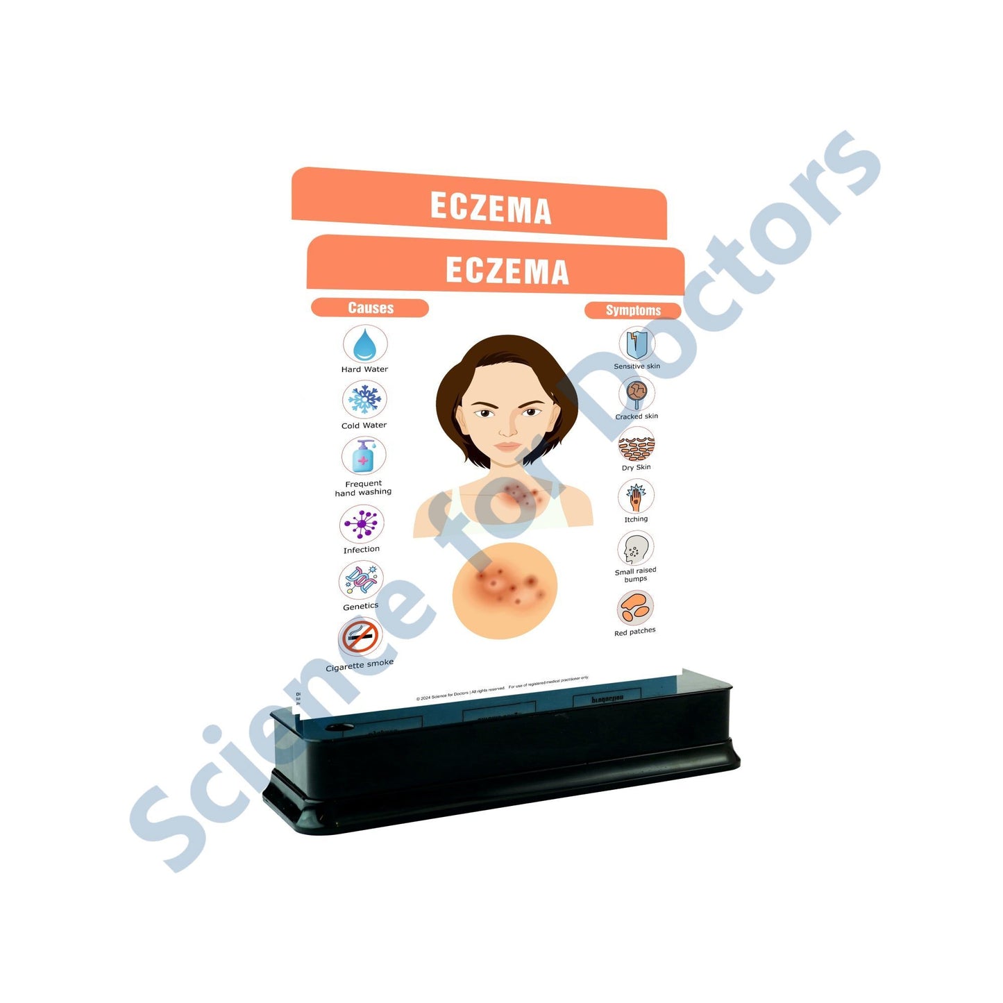 Eczema: 2 Slides on stand
