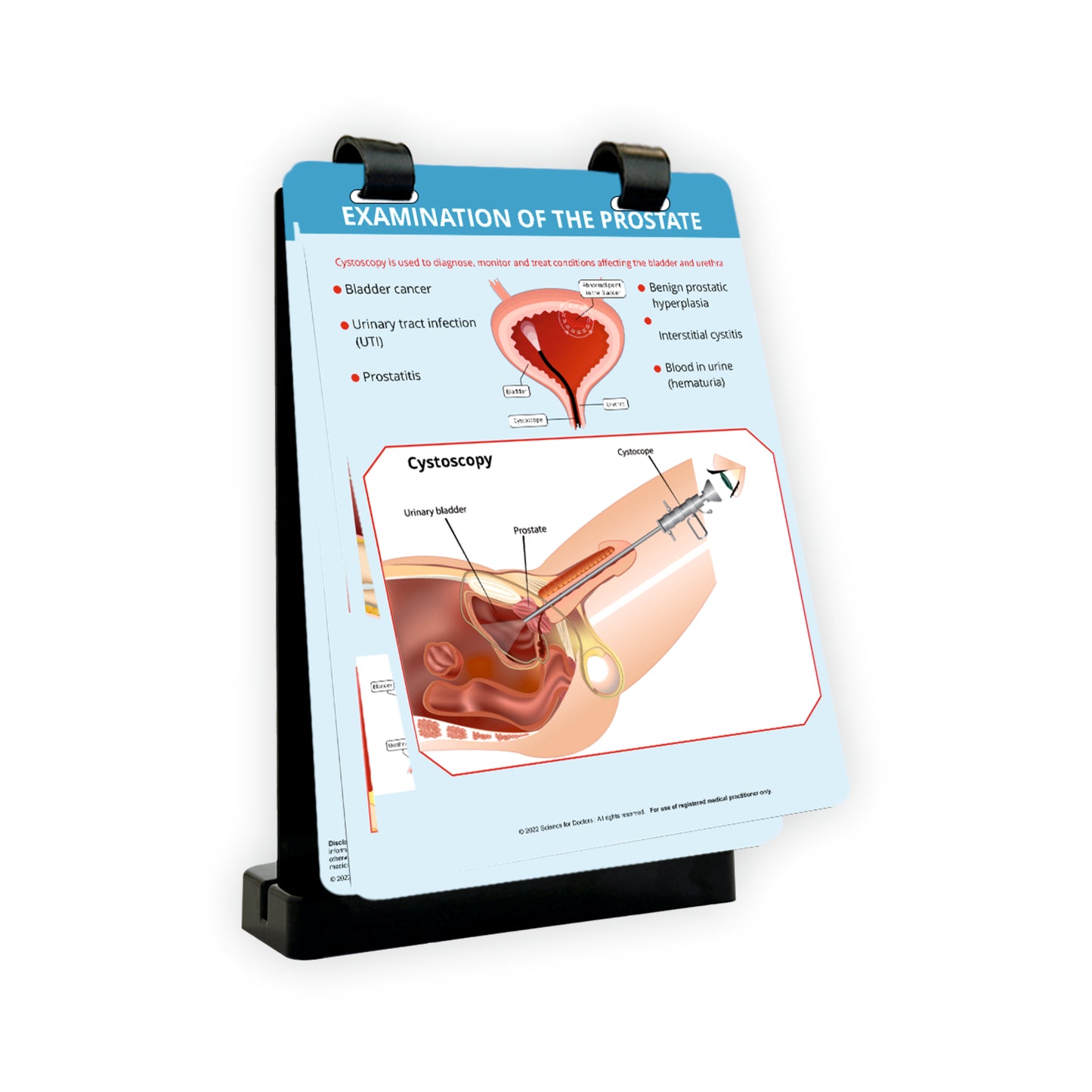 Examination of The Prostate: A4 Flip Wipe