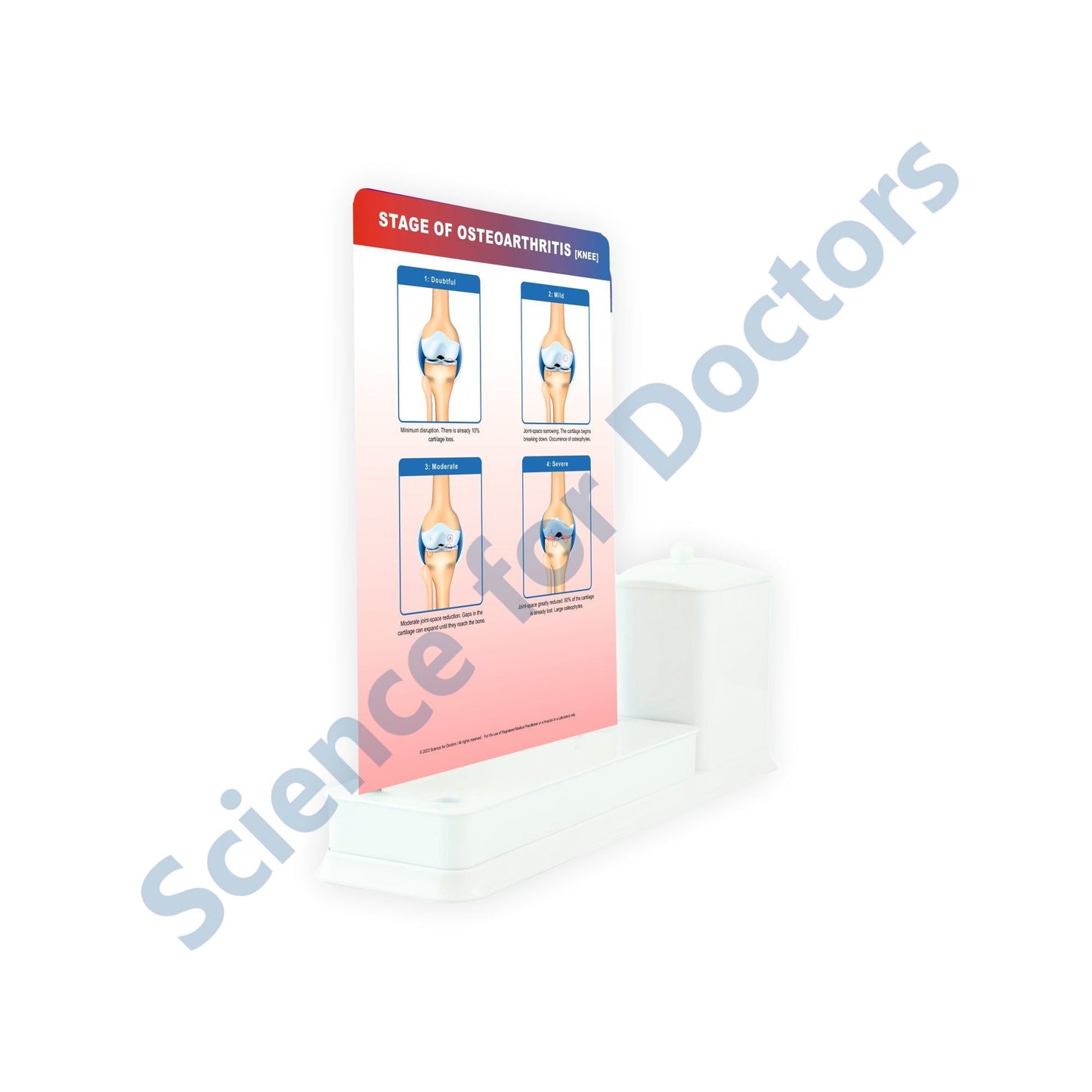 STAGE OF OSTEOARTHRITIS: 1 Slides Write & Wipe with Stationary Stand