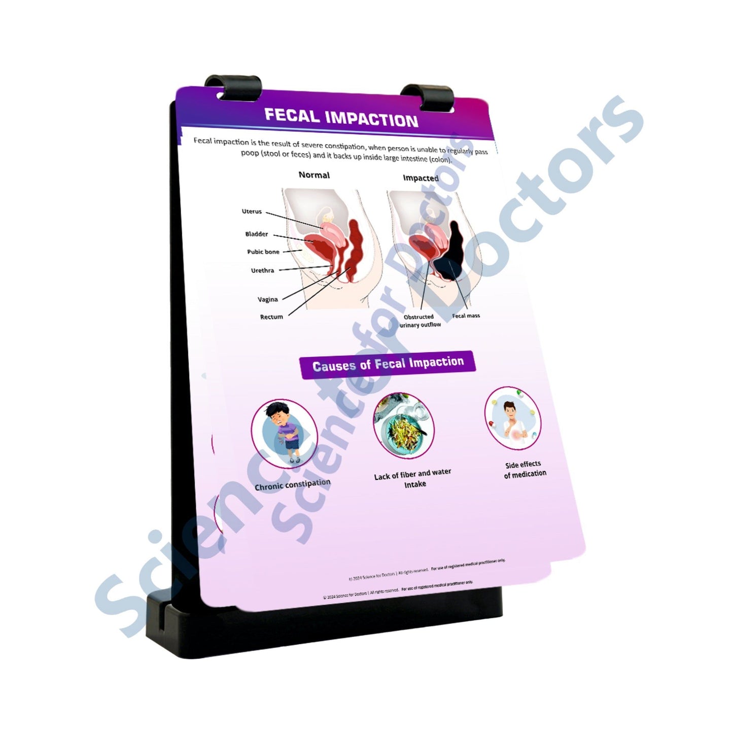 Fecal Impaction: A4 Flip Wipe