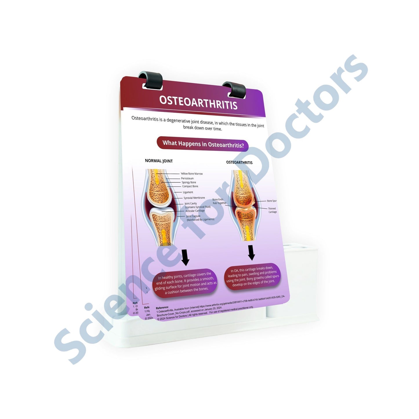 Osteoarthritis: A4 Flip Wipe With Stationary Stand