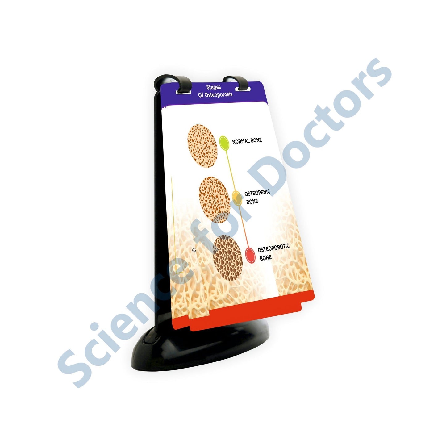 Stages of Osteoporosis: A5 Flip Wipe