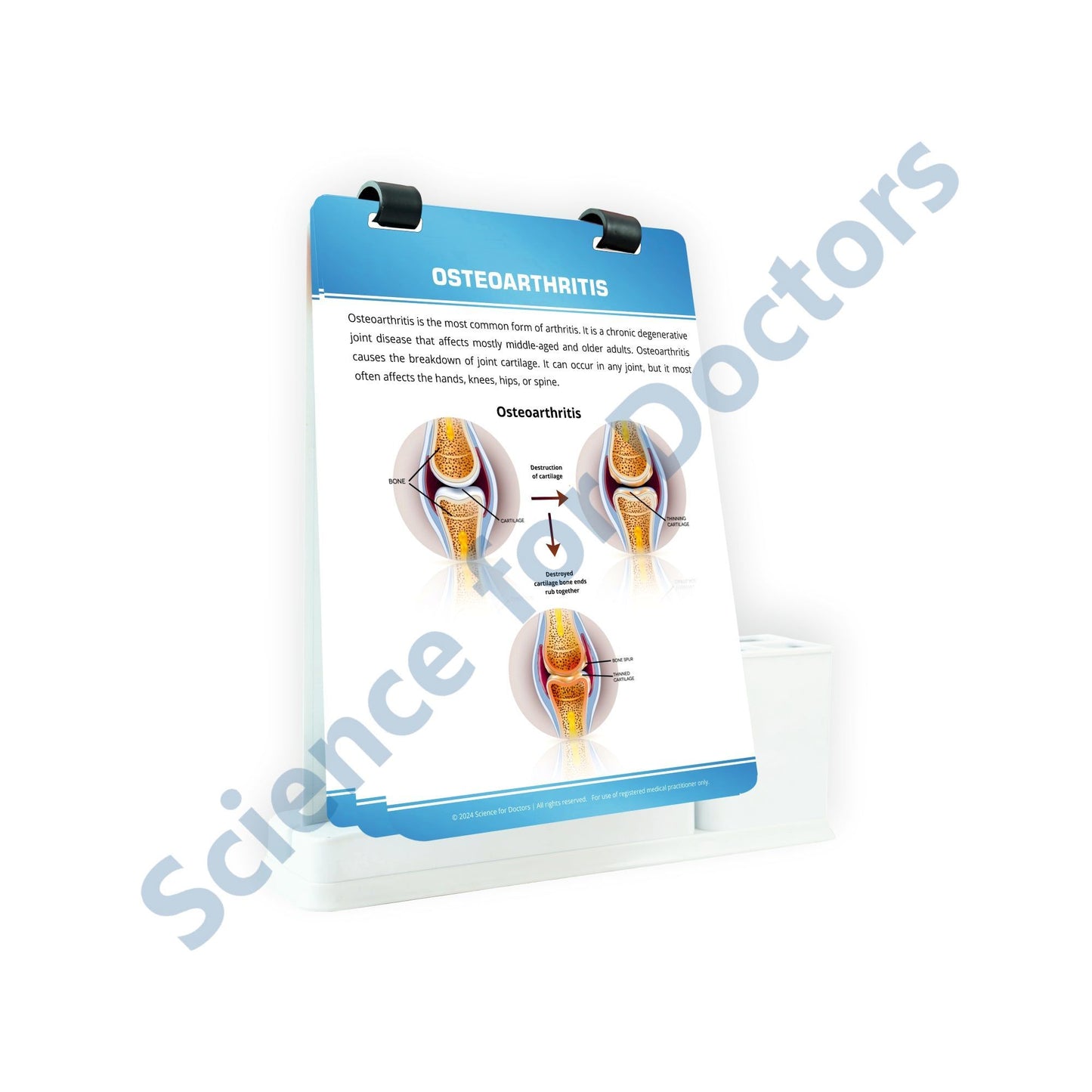 Osteoarthritis: A4 Flip Wipe With Stationary Stand
