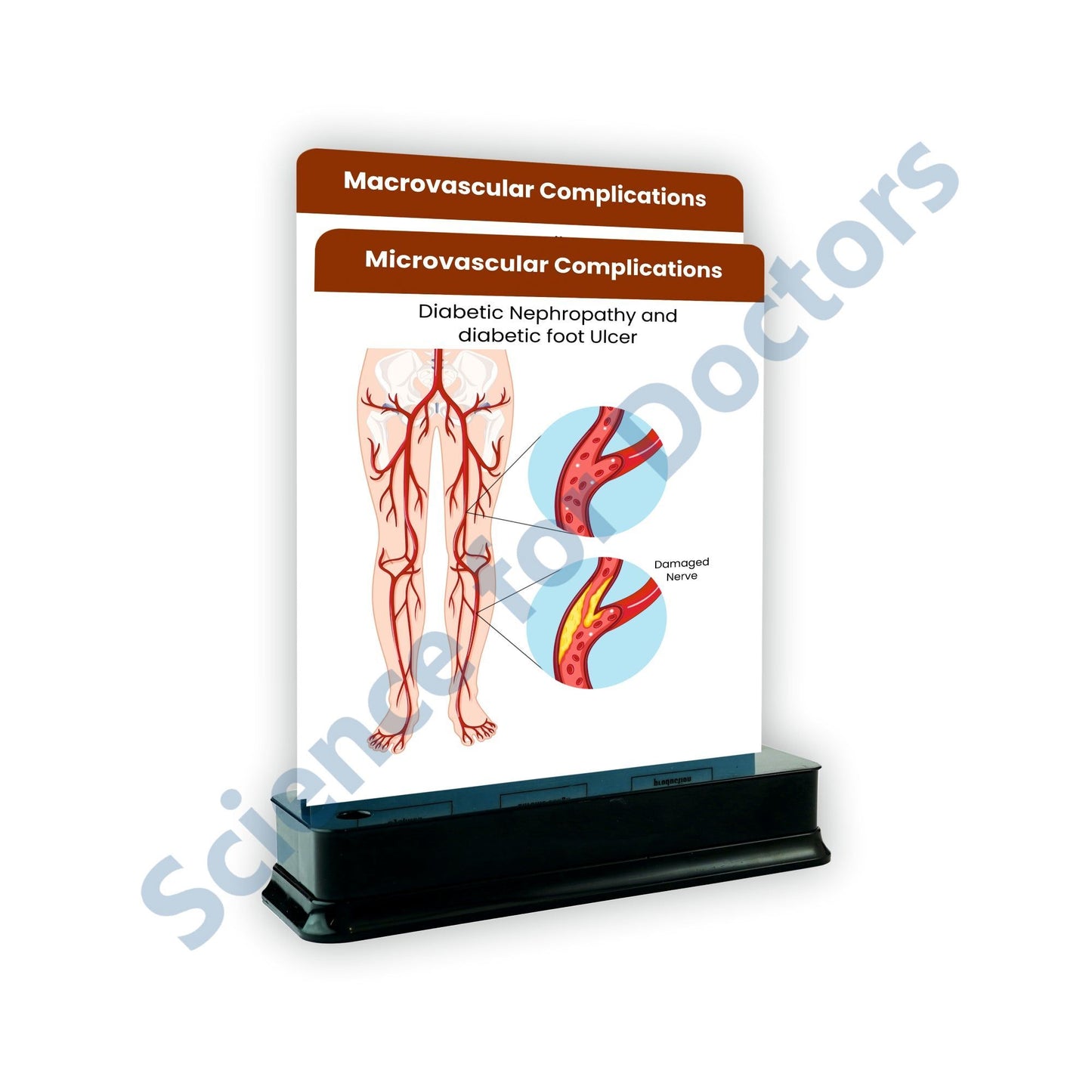 Microvascular Complications: 2 Slide on stand