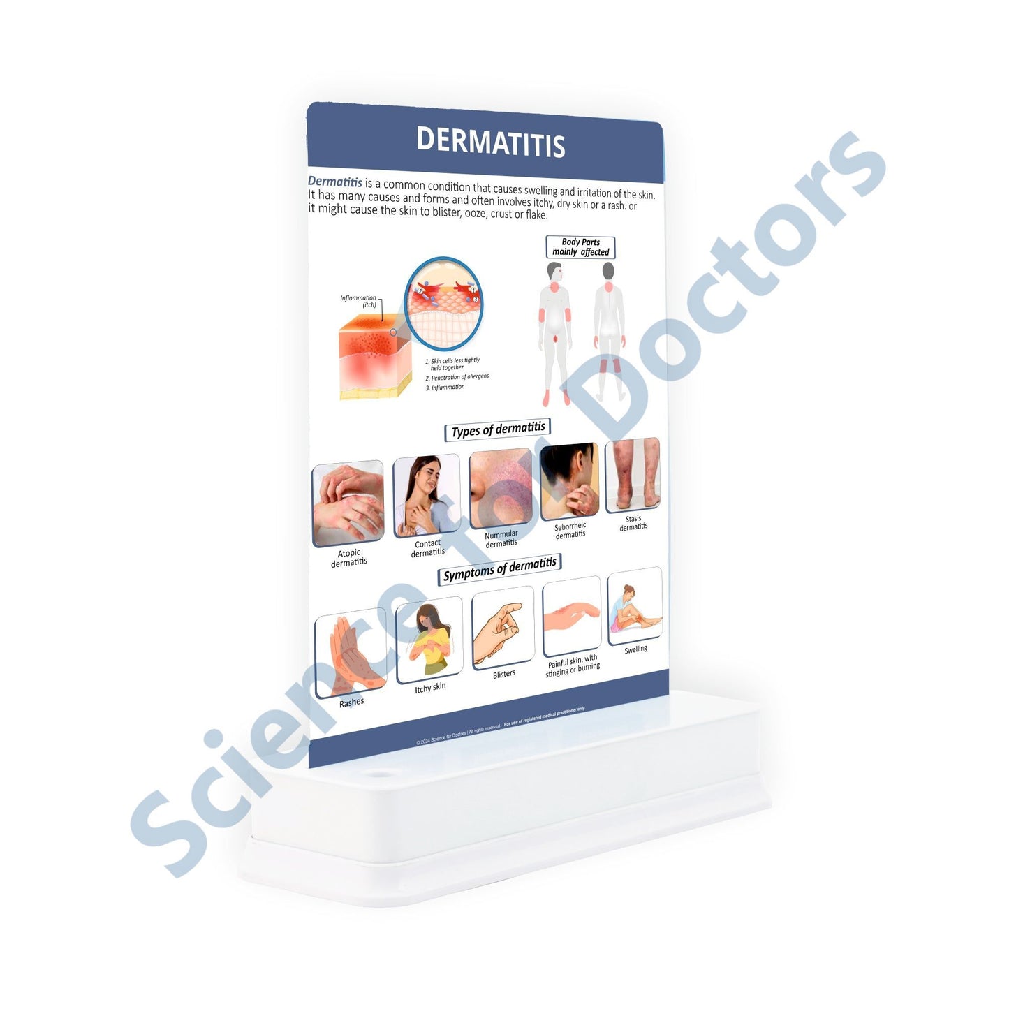 Dermatitis: 1 Slide On Stand