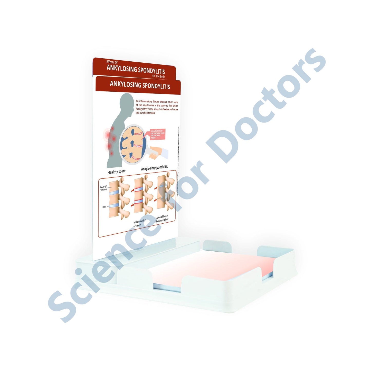 Ankylosing Spondylitis: 2 Slides Patient Leaflet Tray