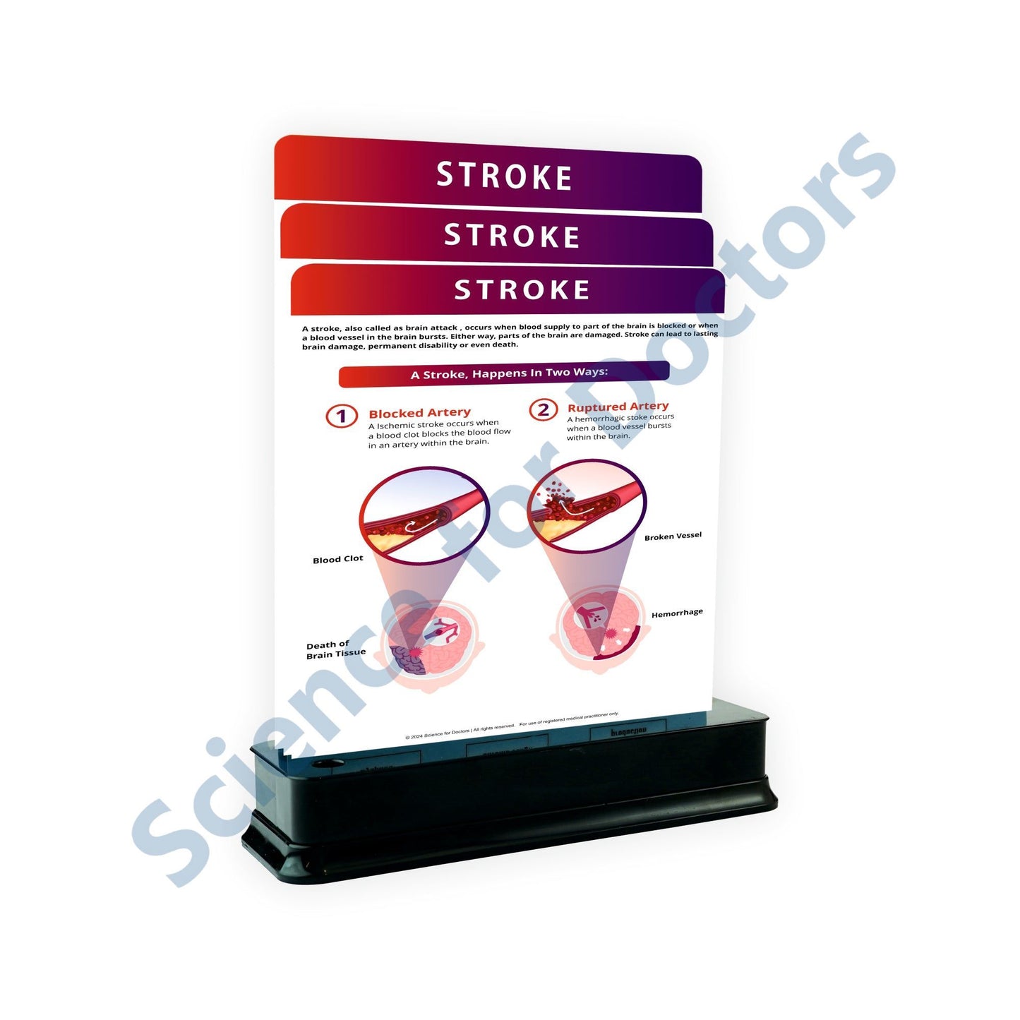 Stroke_1: 3 slide on stand