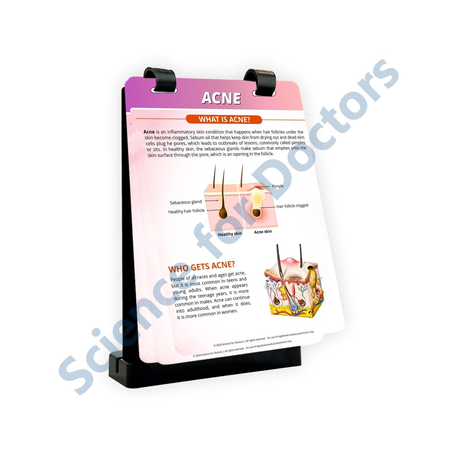 Acne_2: A4 Flip Wipe