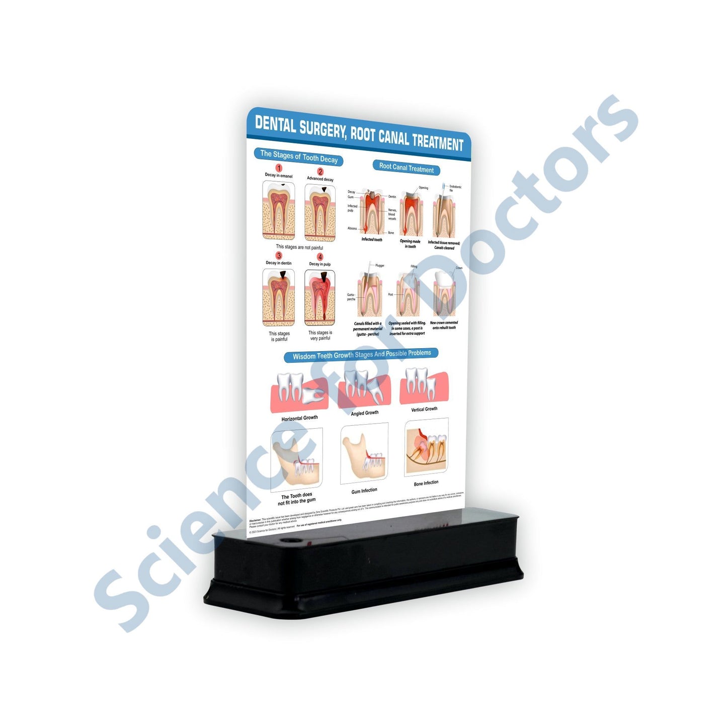 Dental Surgery, Root Canal Treatment : 1 Slide on stand