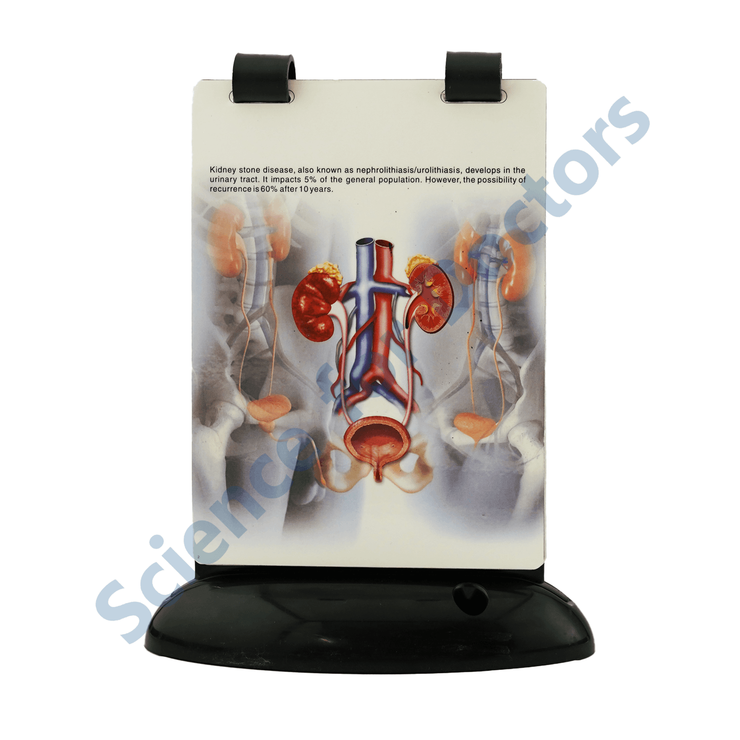 Kidney Stone: A5 Flip Wipe