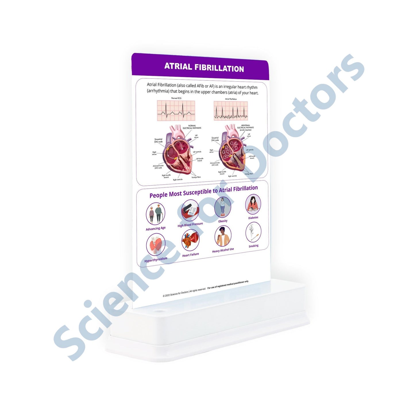 ATRIAL FIBRILLATION: 1 Slide With Stand