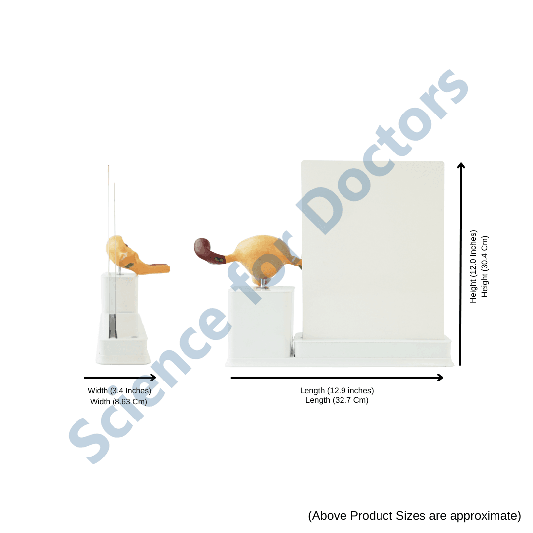 Microvascular Complications : 2 slide Write and Wipe with Anatomical Model