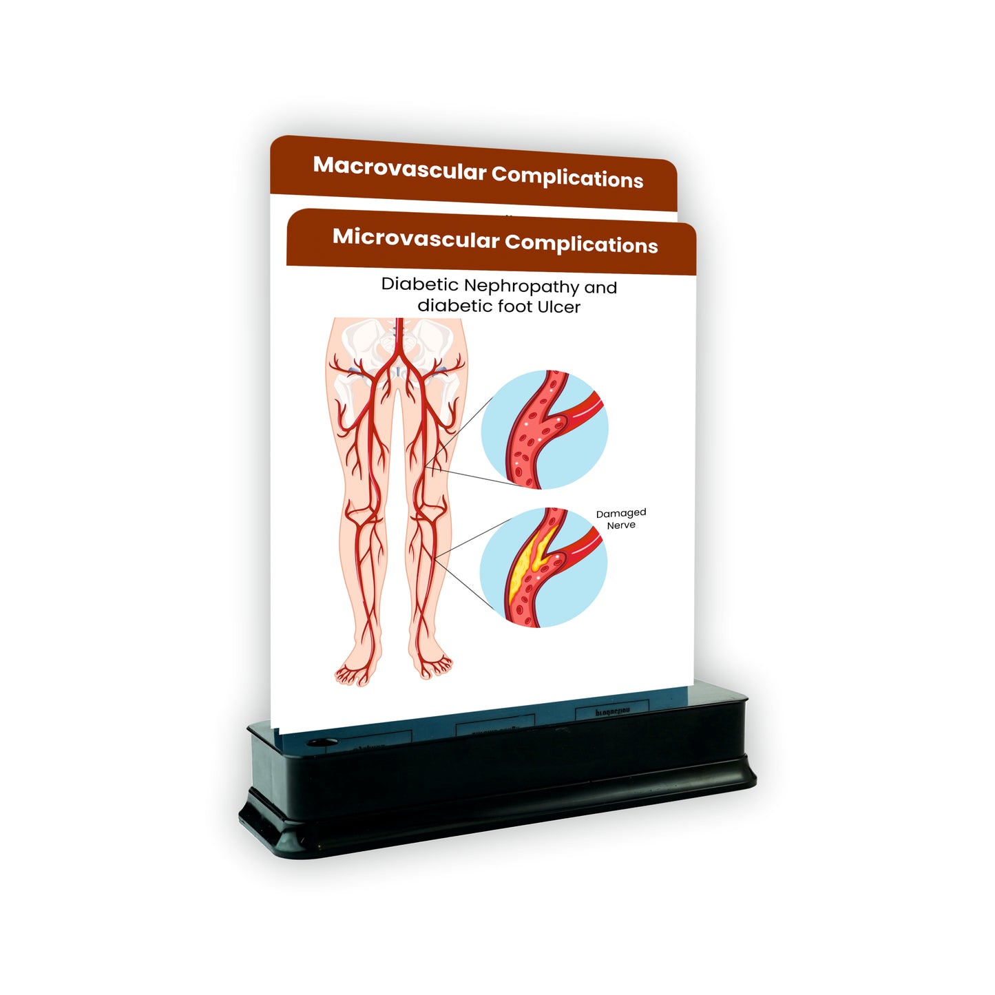 Microvascular Complications_1 : 2 Slides on stand