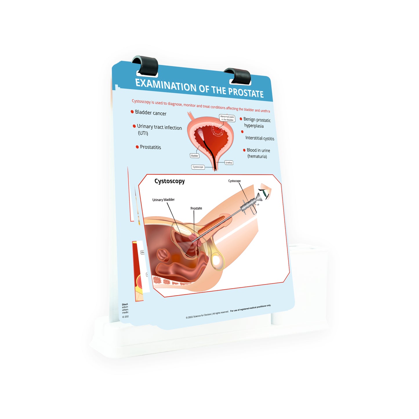 Examination of The Prostate: A4 Flip Wipe With Stationery Stand