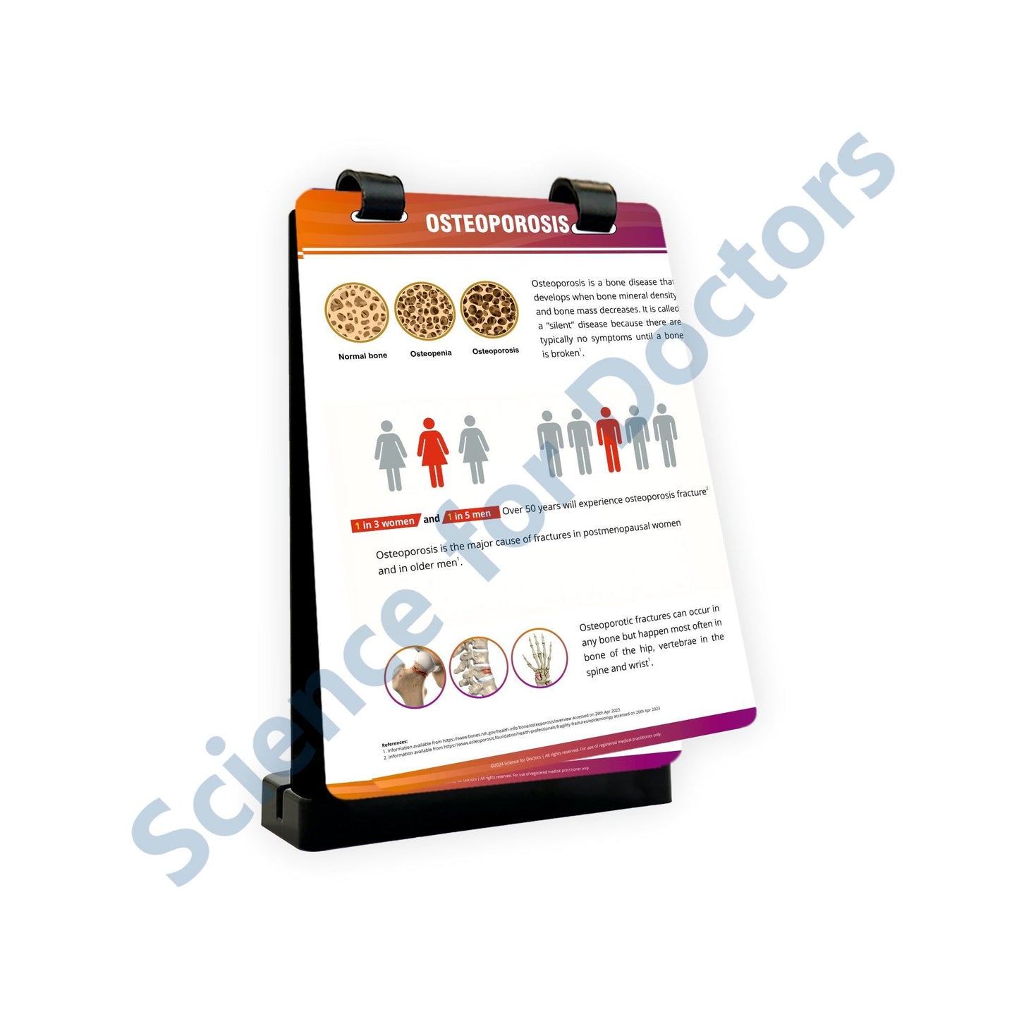 Osteoporosis_1: A4 Flip Wipe