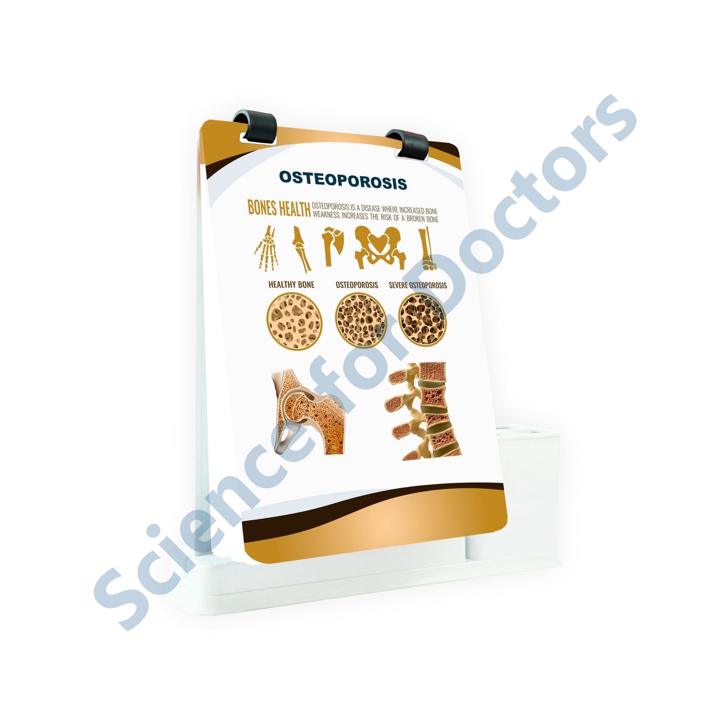 Osteoporosis: A4 Flip Wipe With Stationary Stand