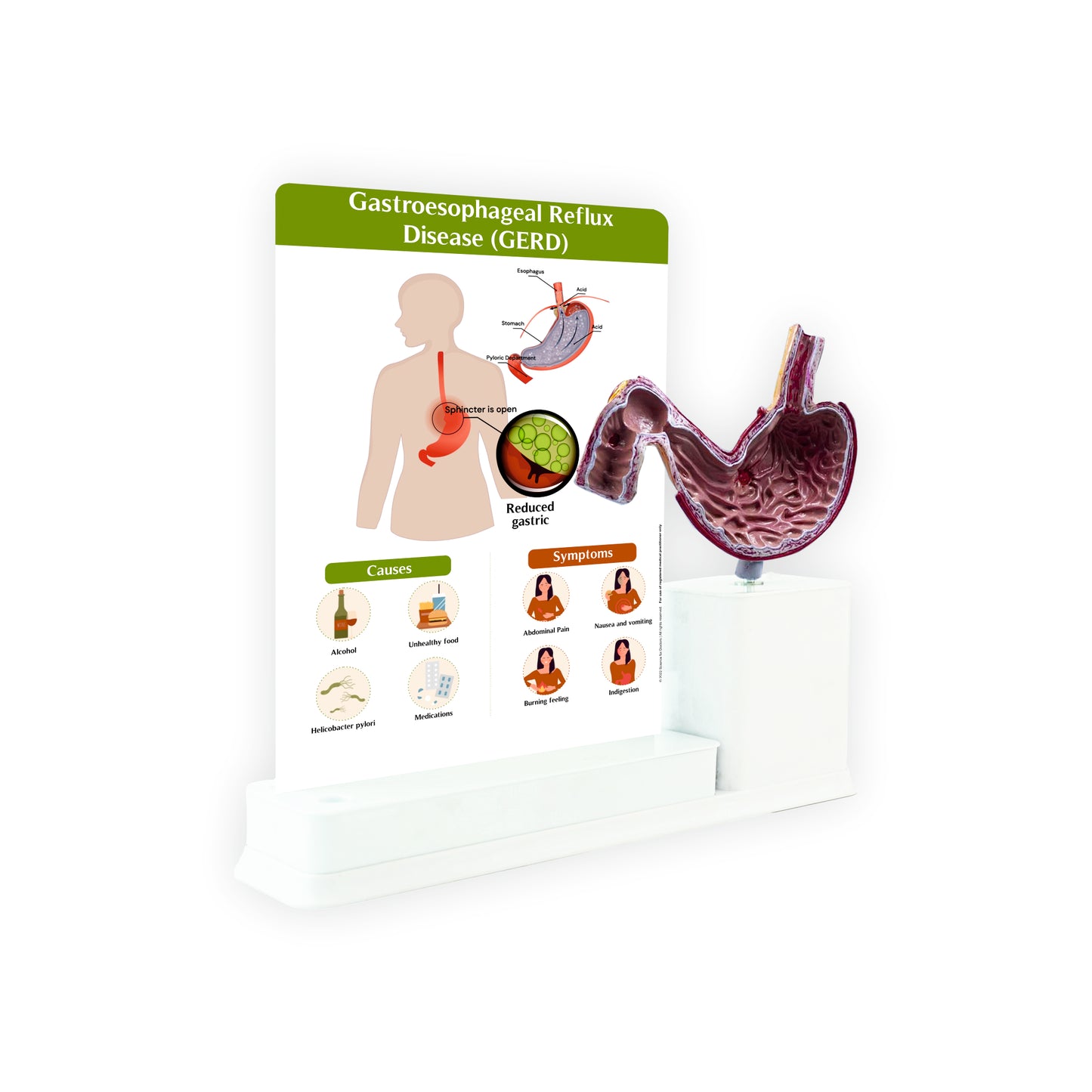 Gastroesophageal Reflux Disease_1: 1 Slide write and wipe with anatomical model on stand