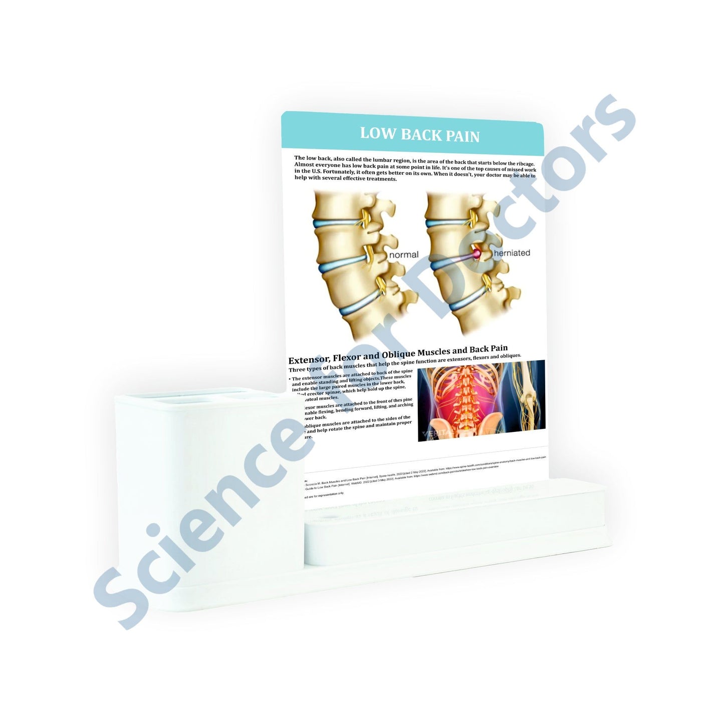 Low Back Pain: 1 Slides Write & Wipe with Stationary Stand