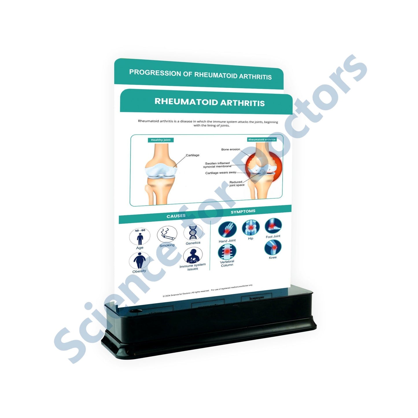 Rheumatoid Arthritis: 2 Slides on stand