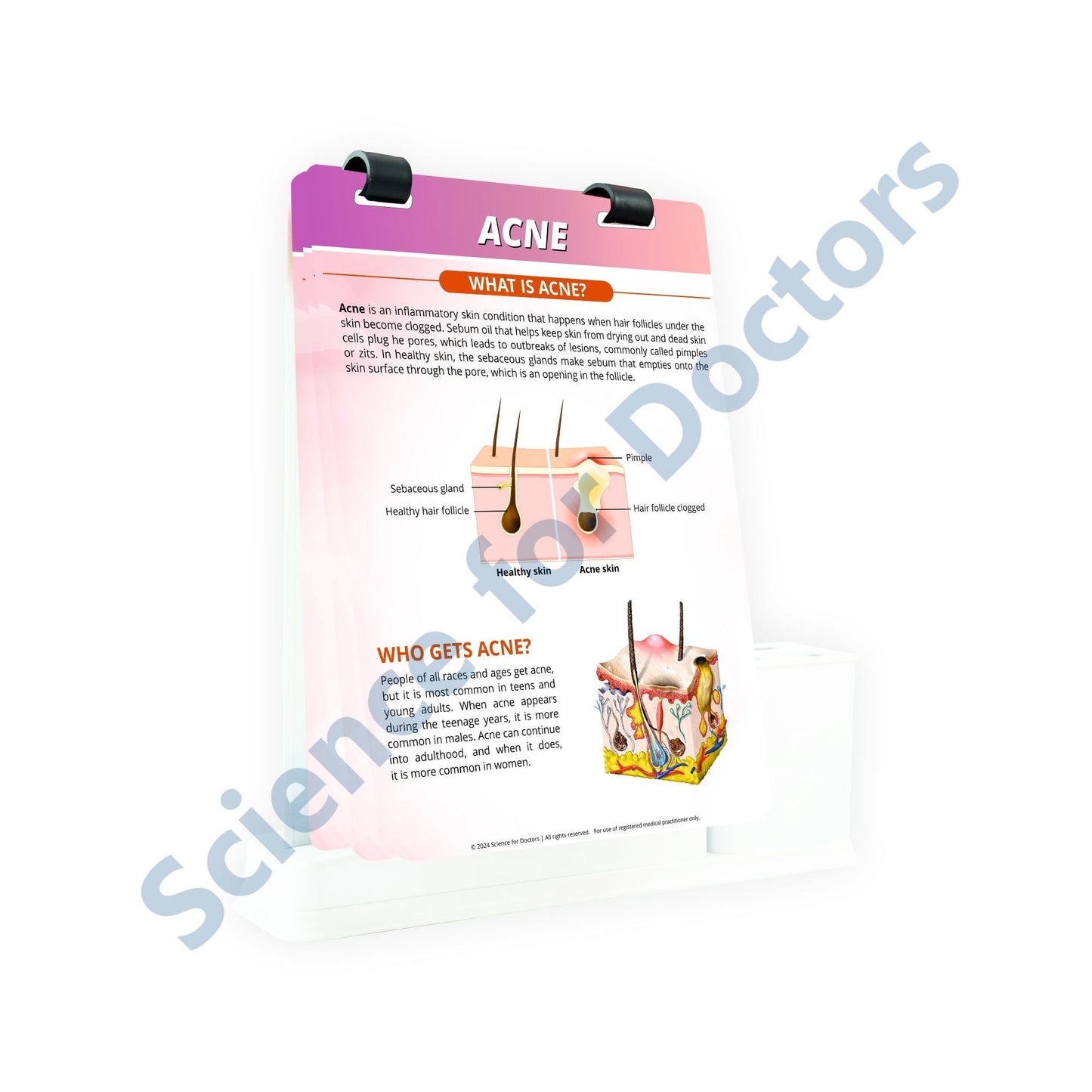 ACNE_1: A4 Flip Wipe With Stationary Stand
