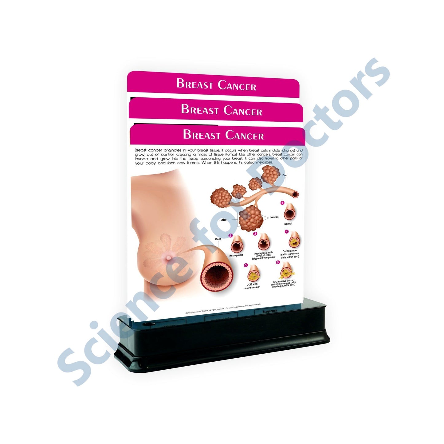 Breast Cancer: 3 slide on stand