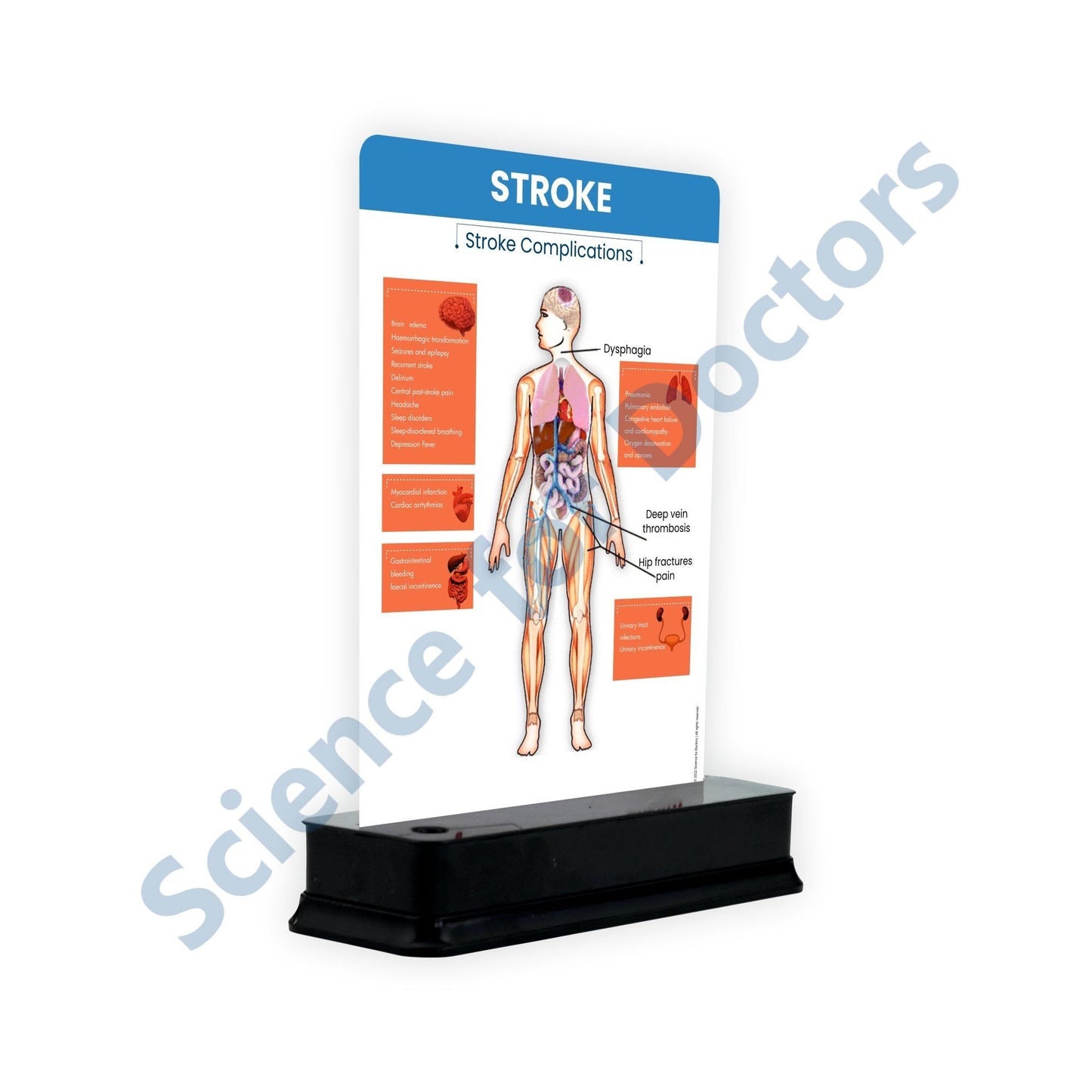Stroke: 1 slide on stand