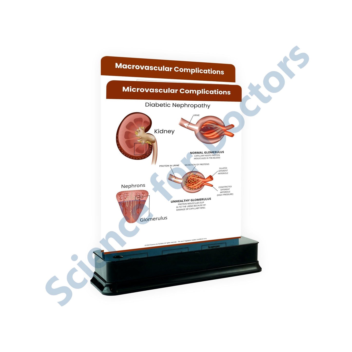 Microvascular Complications: 2 Slides on stand