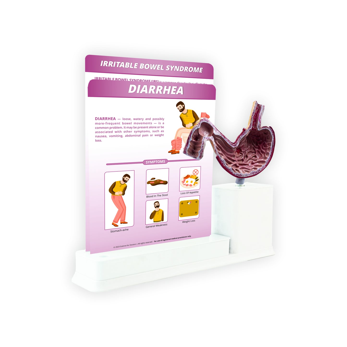 Diarrhea: 2 Slides Write and Wipe with Model On Stand