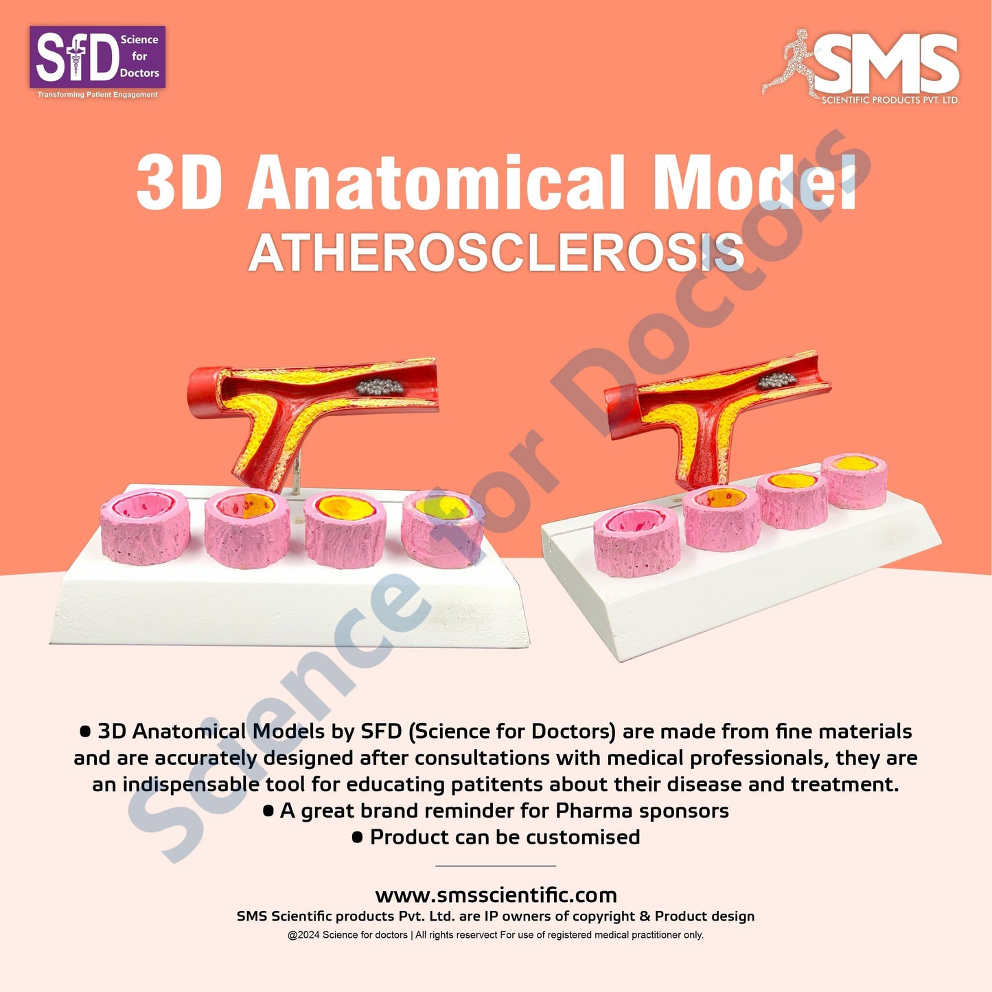 Atherosclerosis: 3D Anatomical Models