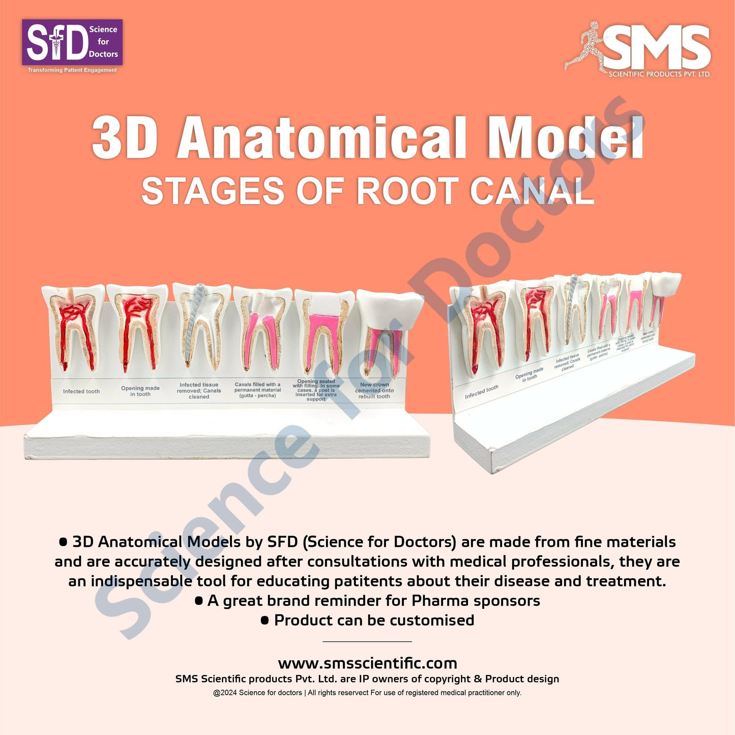 Stages of Root Canal: 3D Anatomical Models