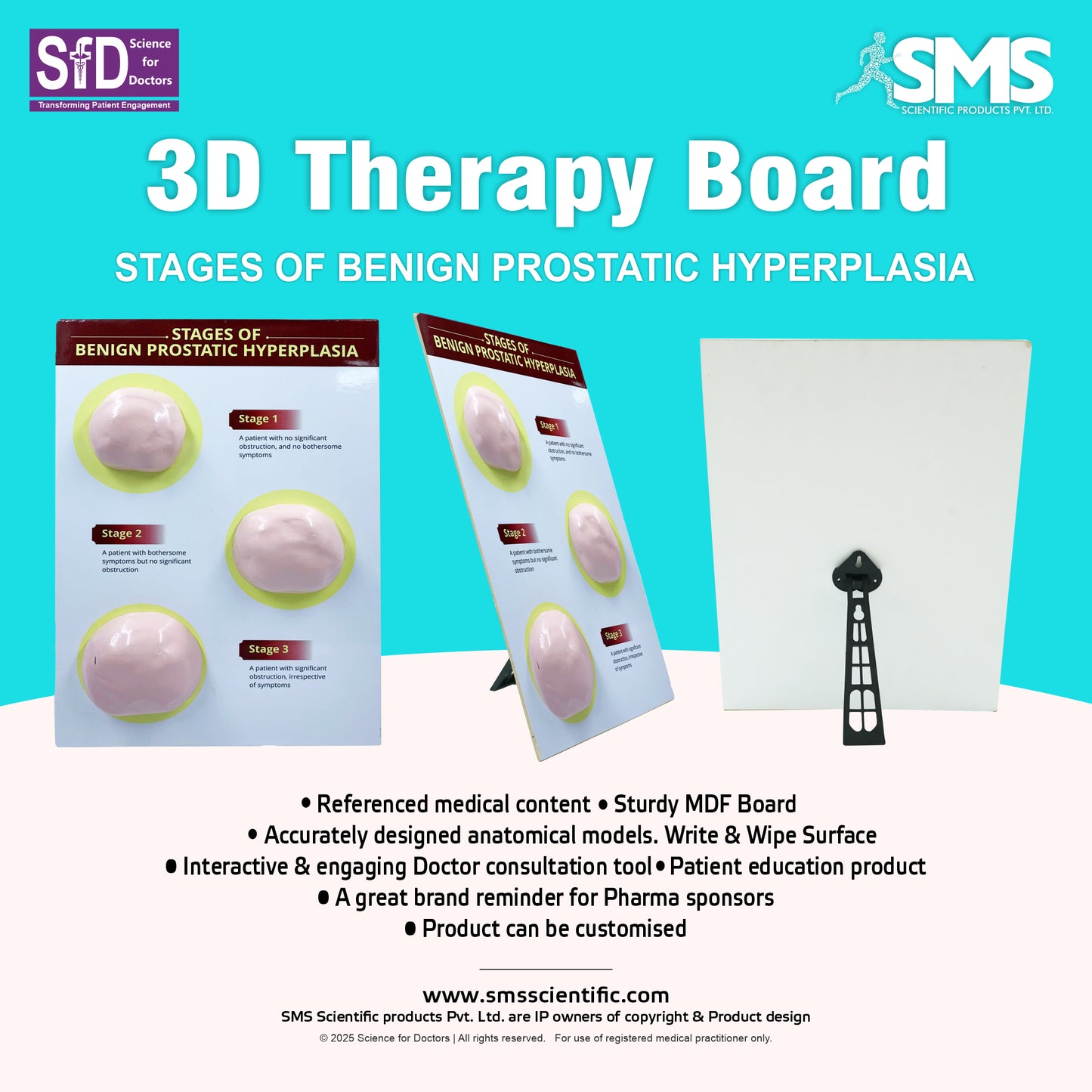 Stages of Benign Prostatic Hyperplasia: 3D Therapy Board