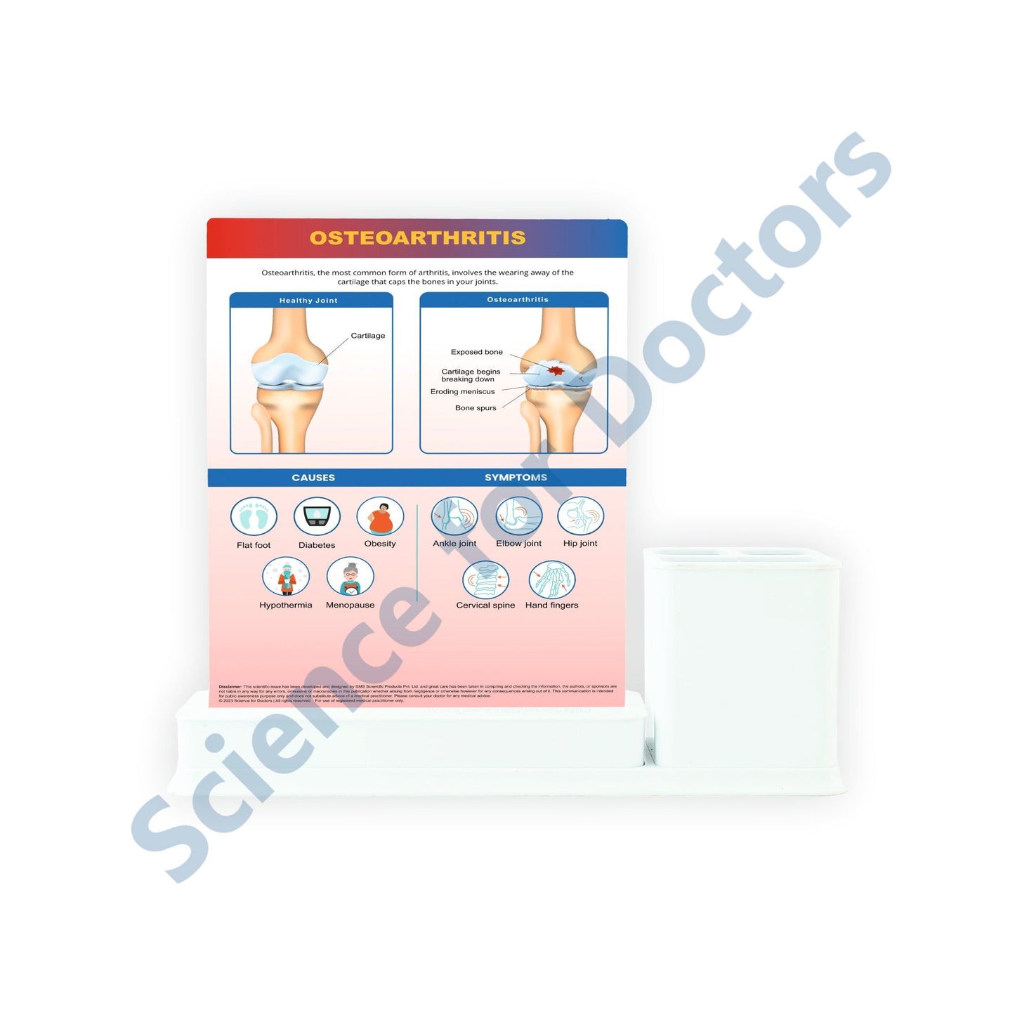 STAGE OF OSTEOARTHRITIS: 1 Slides Write & Wipe with Stationary Stand