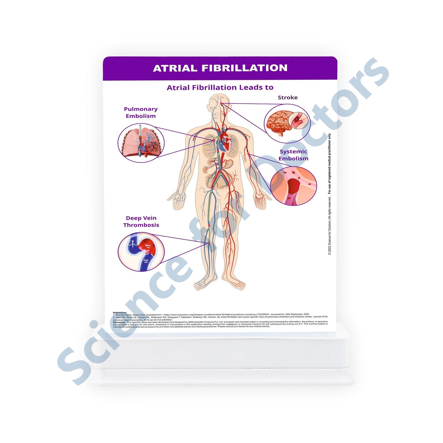 ATRIAL FIBRILLATION: 1 Slide With Stand
