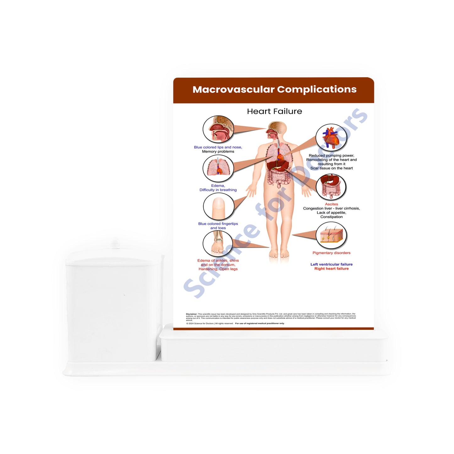 Complications of Diabetes: 3 Slides Write Wipe With Utility Container