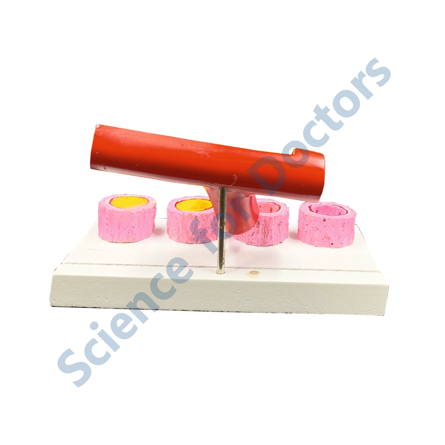 Atherosclerosis: 3D Anatomical Models