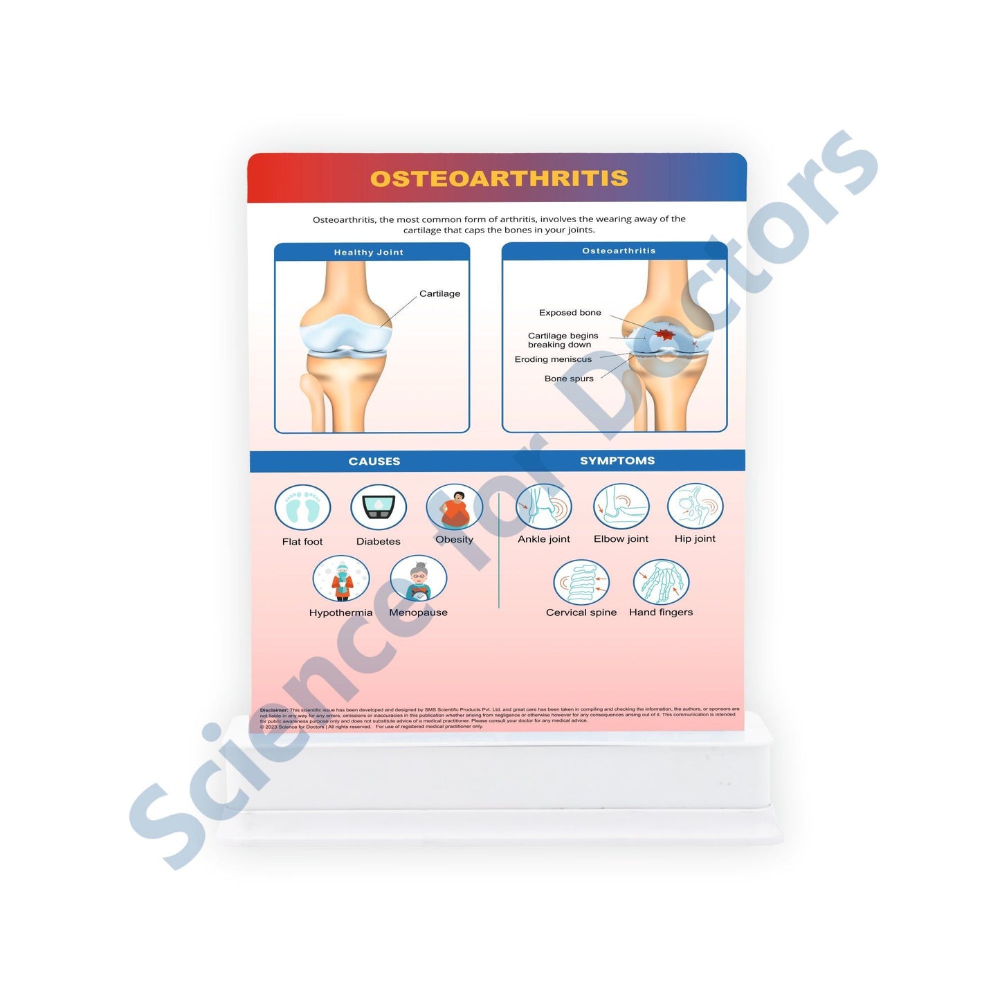STAGE OF OSTEOARTHRITIS: 1 Slide on stand