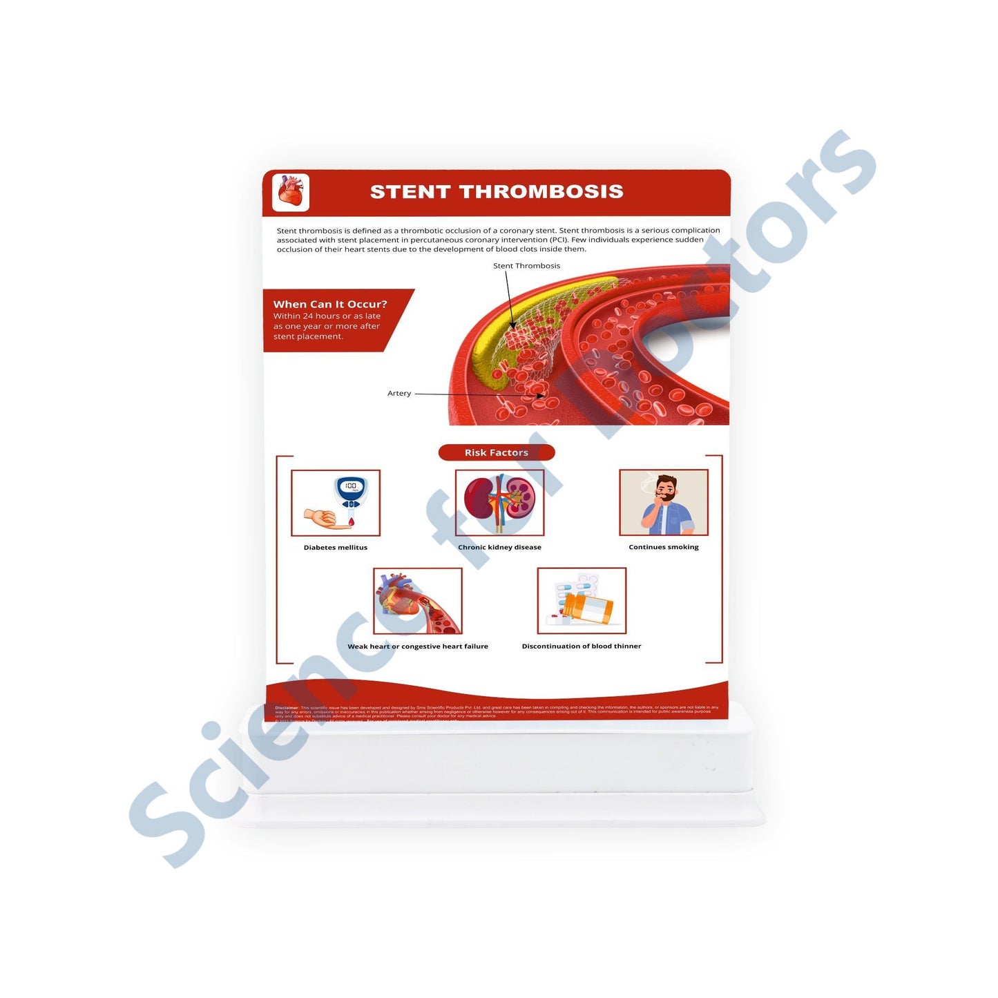 Life After Stent Placement: 1 Slide With Stand